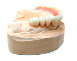 dental crowns lodnon